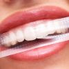 Red PAP+ Teeth Whitening Strips, 7 Sets Strips Dental Kit, Oral Hygiene For Sensitive Teeth